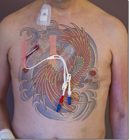 Sean Tiernan Cheerios hickman line